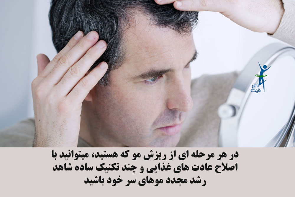 درمان ریزش موی سکه ای با رژیم قلیایی